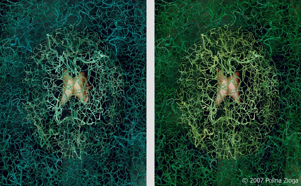 http://polina-zioga.com/files/gimgs/th-41_41_brain-angiography2.jpg