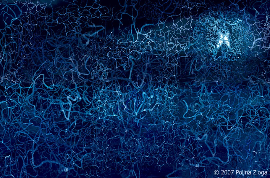 http://polina-zioga.com/files/gimgs/th-41_41_brain-angiography3_v2.jpg