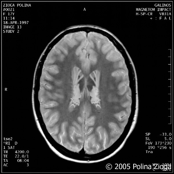 http://polina-zioga.com/files/gimgs/th-47_47_april1997-01.jpg
