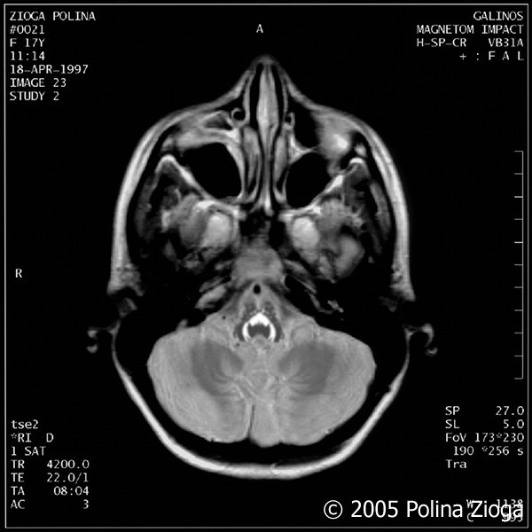 http://polina-zioga.com/files/gimgs/th-47_47_april1997-02.jpg