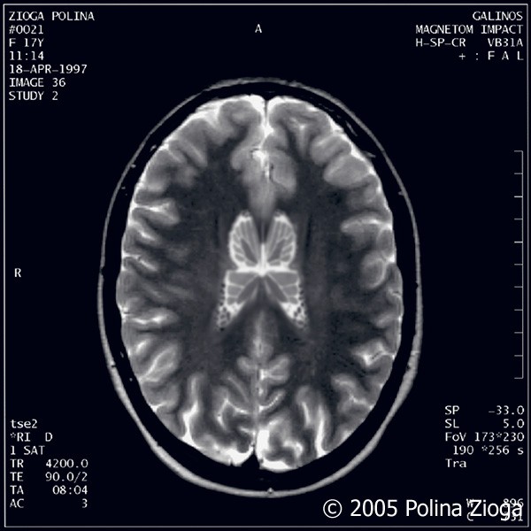 http://polina-zioga.com/files/gimgs/th-47_47_april1997-03.jpg