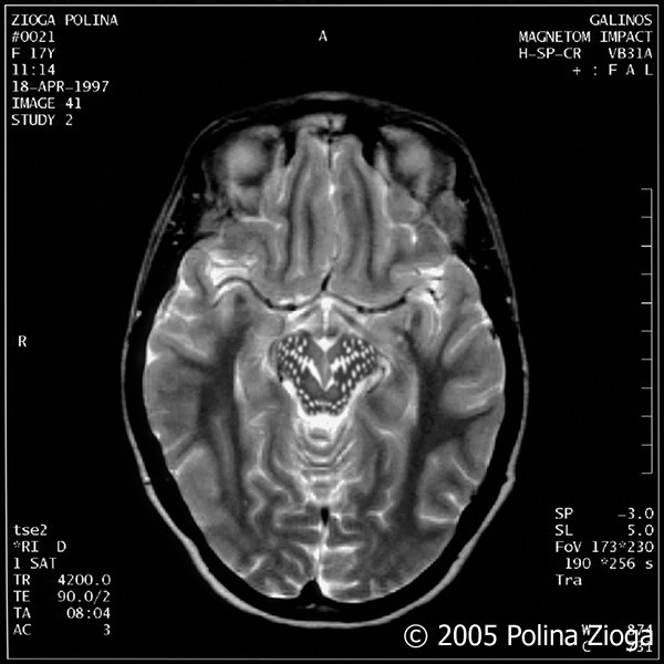 http://polina-zioga.com/files/gimgs/th-47_47_april1997-05.jpg