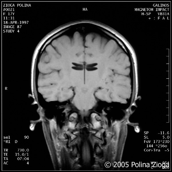 http://polina-zioga.com/files/gimgs/th-47_47_april1997-06.jpg