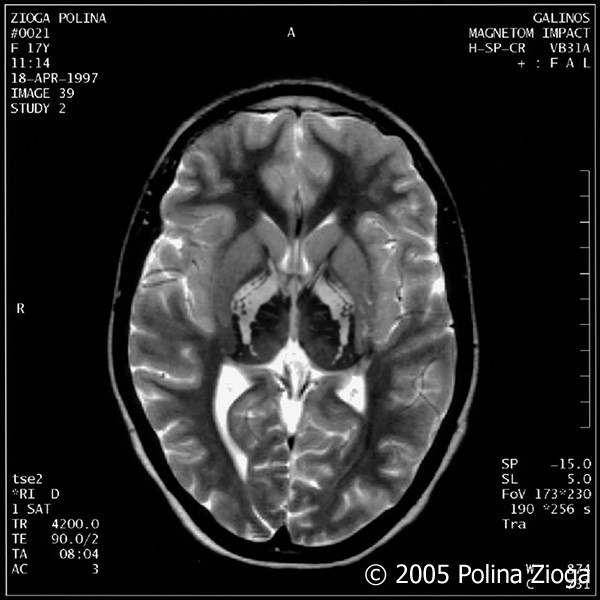http://polina-zioga.com/files/gimgs/th-47_47_april1997-07.jpg