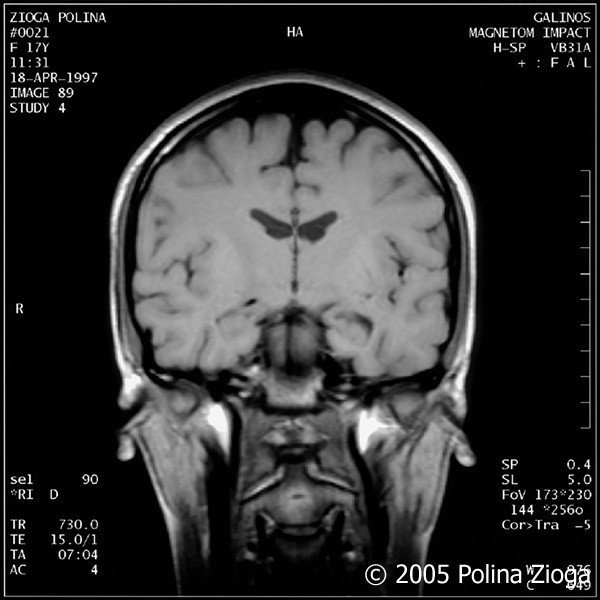 http://polina-zioga.com/files/gimgs/th-47_47_april1997-08.jpg