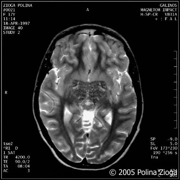 http://polina-zioga.com/files/gimgs/th-47_47_april1997-09.jpg