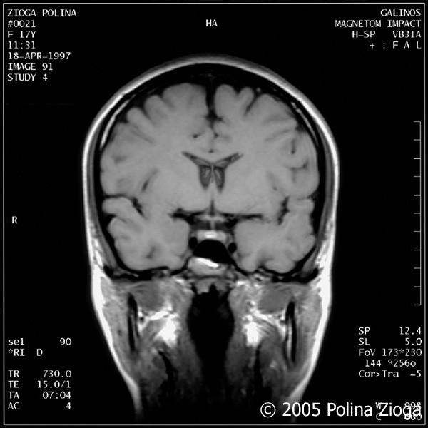 http://polina-zioga.com/files/gimgs/th-47_47_april1997-10.jpg