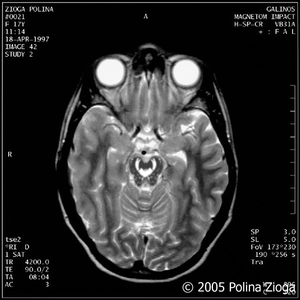 http://polina-zioga.com/files/gimgs/th-47_47_april1997-11.jpg