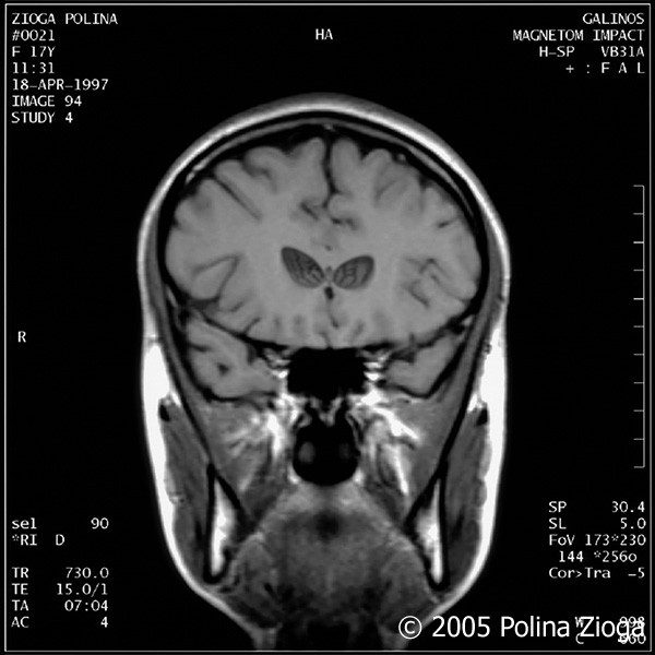 http://polina-zioga.com/files/gimgs/th-47_47_april1997-12.jpg